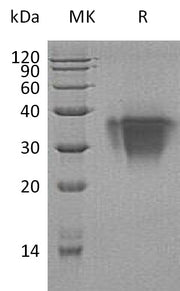 Recombinant Human TWSG1 (C-6His)