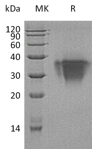 Recombinant Human TWSG1 (C-6His)