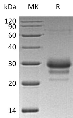 Recombinant Human TFPI-2 (C-6His)