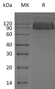 Recombinant Human PDGFRB (C-6His)