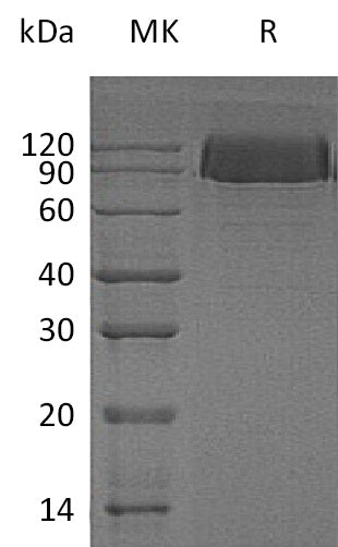 Recombinant Human PDGFRB (C-6His)