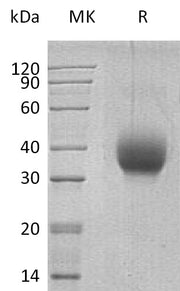 Recombinant Human SLAMF6 (C-6His)
