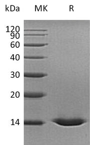 Recombinant Human CST5 (C-6His)