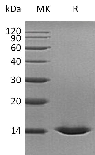 Recombinant Human CST5 (C-6His)