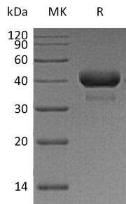 Recombinant Human CTSB (C-6His)