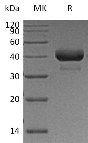 Recombinant Human CTSB (C-6His)