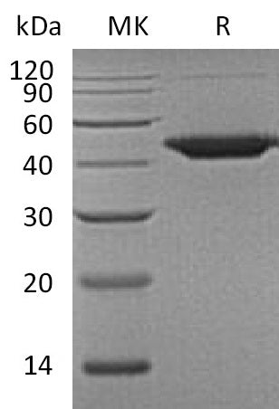 Recombinant Human WIF-1 (C-6His)