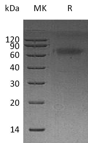 Recombinant Human DKK-3 (C-6His)