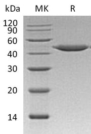 Recombinant Human CTSE (C-6His)