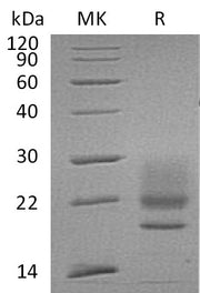 Recombinant Human CD83 (C-6His)