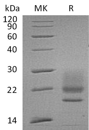 Recombinant Human CD83 (C-6His)