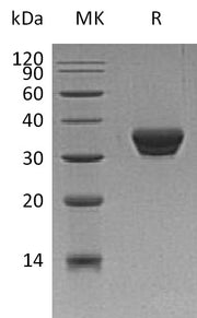 Recombinant Human ASAM (C-6His)