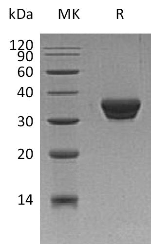 Recombinant Human ASAM (C-6His)