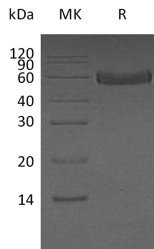 Recombinant Human Fetuin A (C-6His)