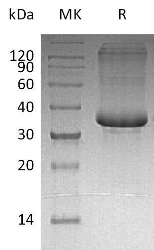 Recombinant Human SP-10 (C-6His)