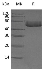 Recombinant Human ACPP (C-6His)