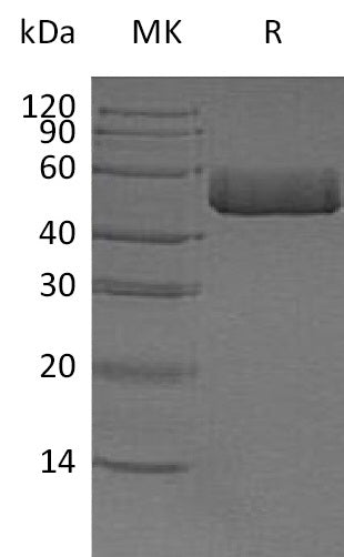Recombinant Human ACPP (C-6His)