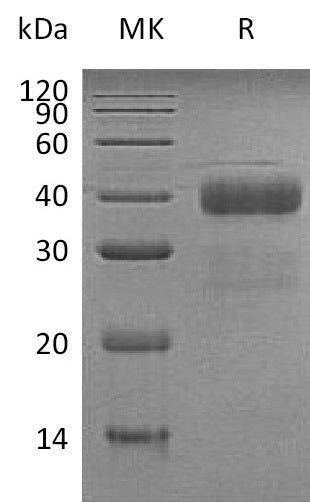 Recombinant Human KLK5 (C-6His)