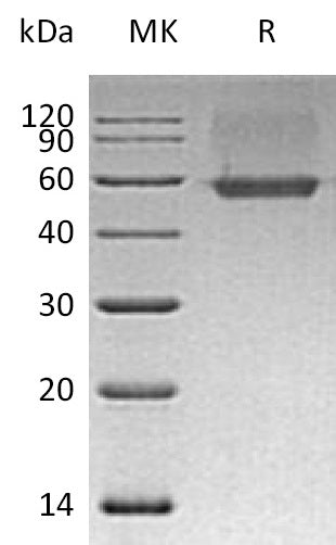 Recombinant Human AGER (C-6His)
