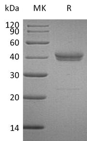 Recombinant Human CADM3 (C-6His)