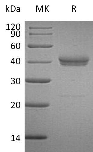 Recombinant Human CADM3 (C-6His)