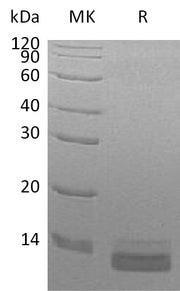 Recombinant Human CCL14 (C-6His)
