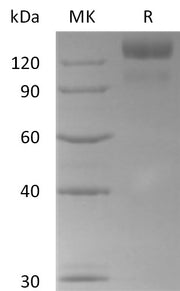 Recombinant Human BAI3 (C-6His)