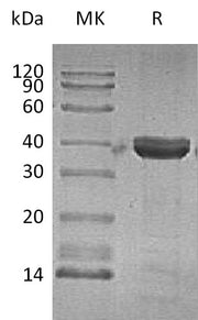 Recombinant Human CTSZ (C-6His)