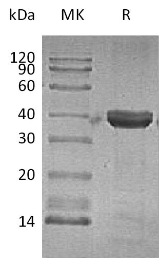 Recombinant Human CTSZ (C-6His)