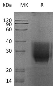 Recombinant Human EMMPRIN (C-6His)