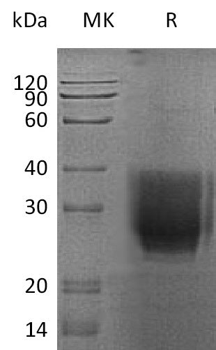 Recombinant Human EMMPRIN (C-6His)