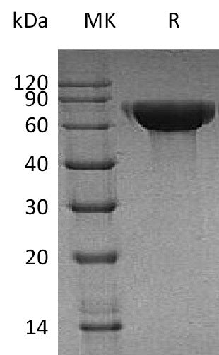 Recombinant Human CNDP1 (C-6His)