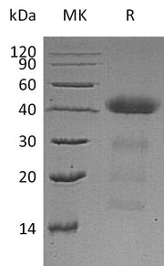 Recombinant Human AZGP1 (C-6His)