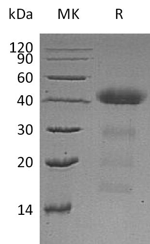 Recombinant Human AZGP1 (C-6His)