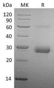 Recombinant Human TIMP-1 (C-6His)