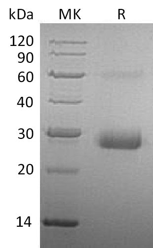 Recombinant Human TIMP-1 (C-6His)
