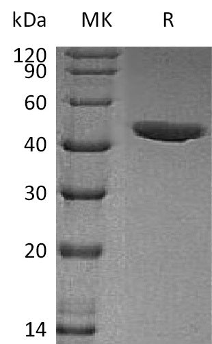 Recombinant Human CHI3L1 (C-6His)