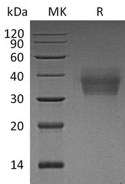 Recombinant Human LMIR2 (C-6His)