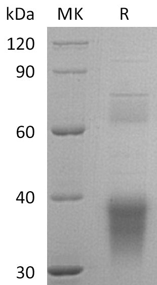 Recombinant Human Clusterin (C-6His)