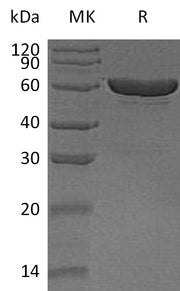 Recombinant Human CES1 (C-6His)