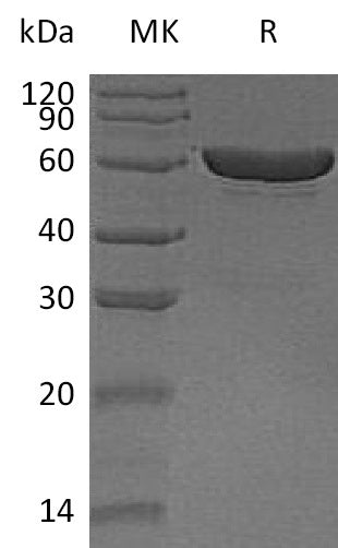 Recombinant Human CES1 (C-6His)
