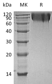 Recombinant Human CEACAM1 (C-6His)