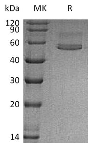 Recombinant Human CHIT1 (C-6His)