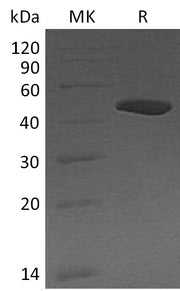Recombinant Human CPB1 (C-6His)