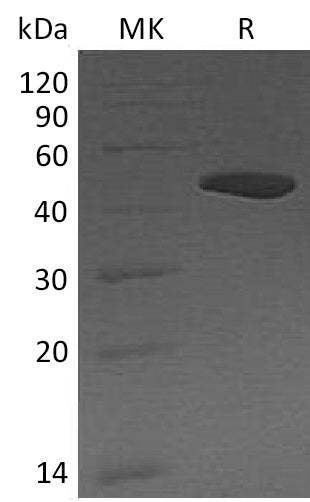 Recombinant Human CPB1 (C-6His)