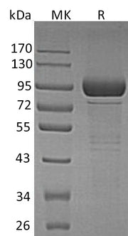 Recombinant Human GLB1 (C-6His)