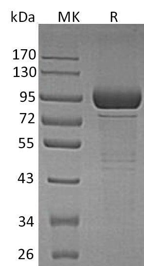 Recombinant Human GLB1 (C-6His)