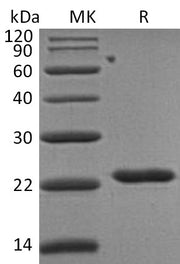 Recombinant Human TIMP-2 (C-6His)
