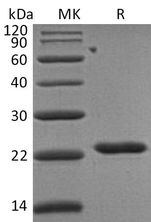 Recombinant Human TIMP-2 (C-6His)