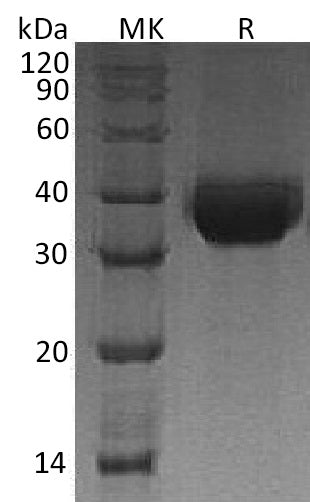 Recombinant Human DLK-1 (C-6His)